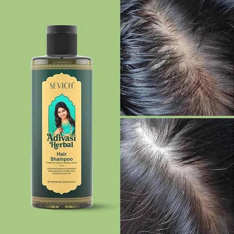 SEVICH Herbal Hair Growth Oil Set Ayurvedic Fast Hair Regrowth Thicken Serum India Adivasi Anti Hair Loss Hair Care Shampoo